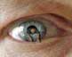 Small photo of man's eye